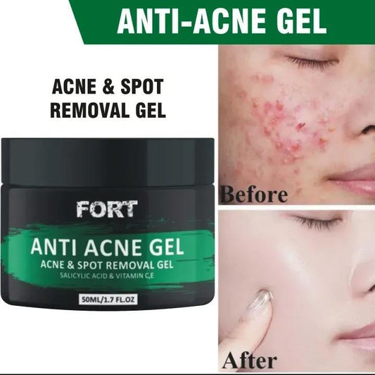 Fort Acne Scar Removal Exfoliating Gel - Fashion Lovers