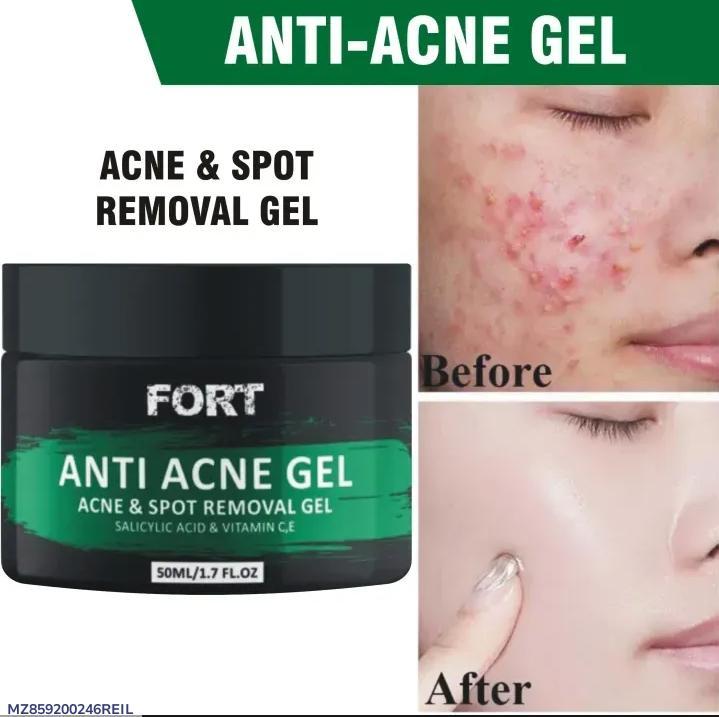 Fort Acne Scar Removal Exfoliating Gel - Fashion Lovers