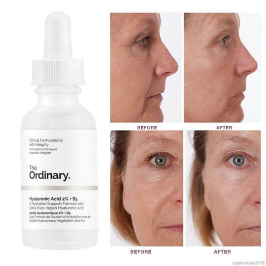 Ordinary Hyaluronic Acid Hydrating Face Serum, 30 Ml - Fashion Lovers